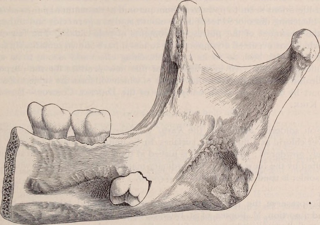 Страница из стоматологического учебника университета Филадельфии. 1893 год. Фотоархив Wikipedia