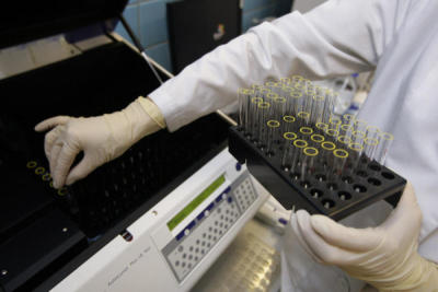 Москвичи смогут пройти бесплатный тест на гепатит