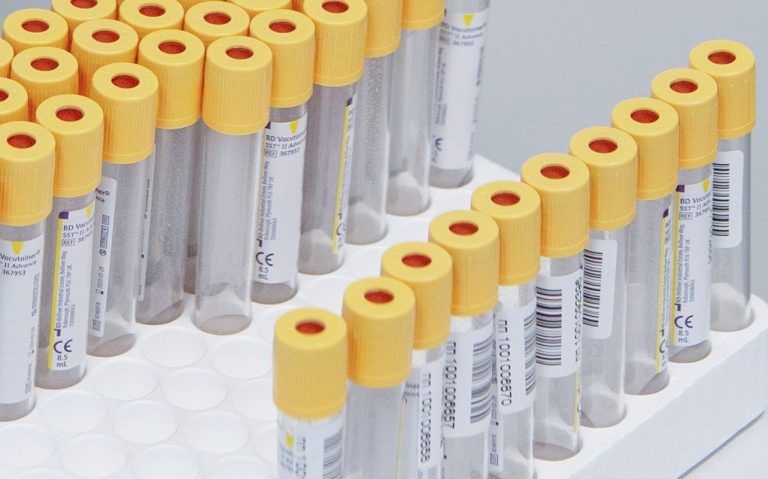 В Москве провели 3 миллиона ПЦР-тестов на коронавирус