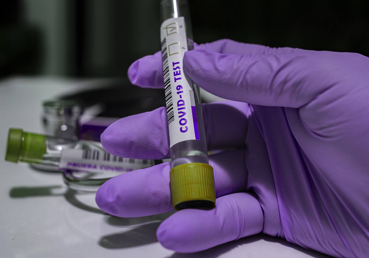 Врачи выявили за минувшие сутки 13 436 случаев заболевания коронавирусом