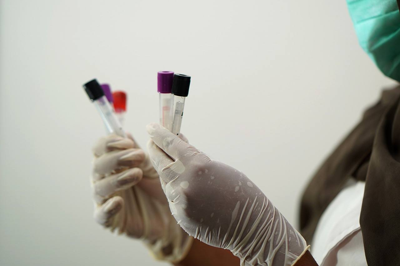 Врачи выявили за минувшие сутки 15 318 случаев заболевания коронавирусом